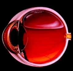 retina-dekolmani-tedavisi