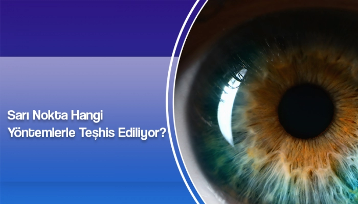 sari-nokta-hangi-yontemlerle-teshis-ediliyor-ates-yanyali