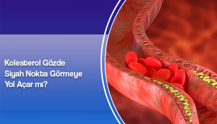 kolesterol-gozde-siyah-nokta-gormeye-yol-acar-mi-ates-yanyali