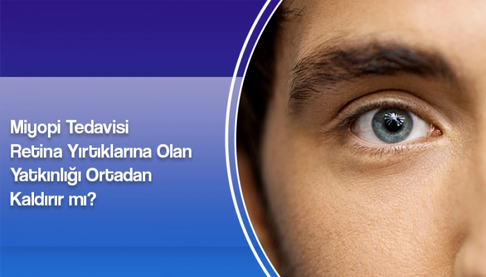 miyopi-tedavisi-retina-yirtiklarina-olan-yatkinligi-ortadan-kaldirir-mi-ate-yanyali