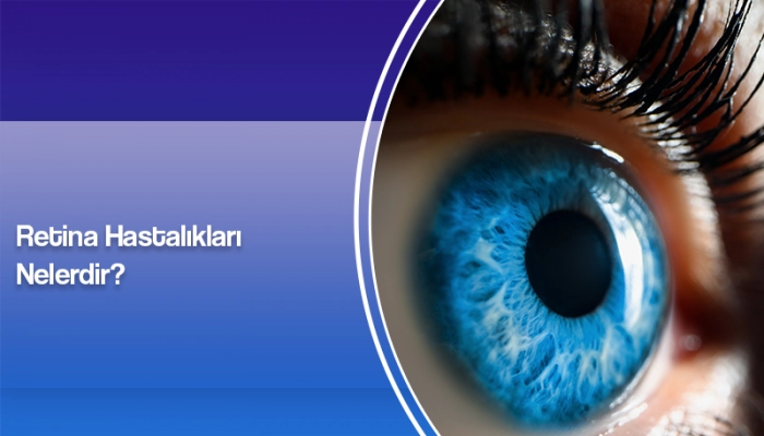 retina-hastaliklari-nelerdir-ates-yanyali