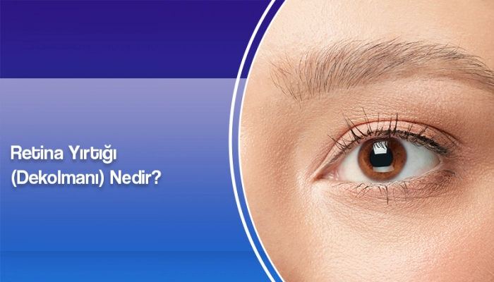 retina-yirtigi-dekolmani-nedir-ates-yanyali