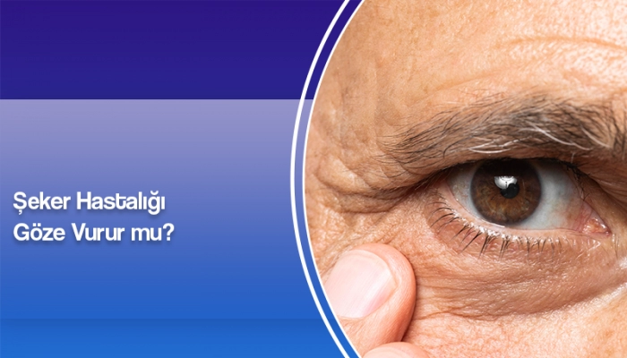 seker-hastaligi-goze-vurur-mu-ates-yanyali