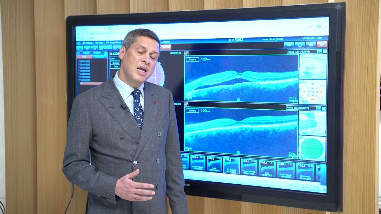 sarı nokta hastalığı,sarı nokta,sarı nokta tedavisi,sarı nokta hastalığı nasıl tedavi edilir