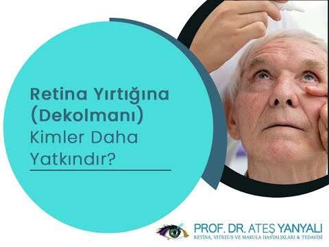 retina yırtığı,retina dekolmanı,retina dekolmanı tedavisi,ateş yanyalı,istanbul retina tedavisi