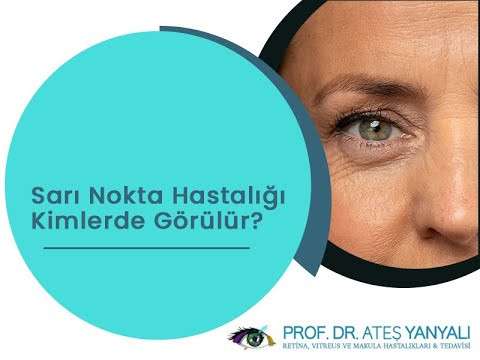 sarı nokta hastalığı,sarı nokta tedavisi,makula nedir,makula dejenerasyonu