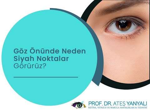 ateş yanyalı,doç dr ateş yanyalı,siyah noktalar,sinekler görmek