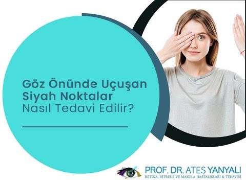siyah noktalar,siyah noktaların tedavisi,siyah noktalar nasıl tedavi edilir