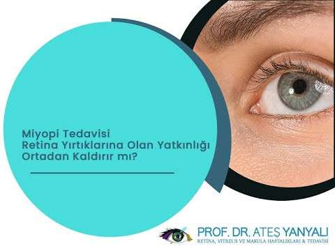 miyopi uzmanı,miyopi tedavisi,çocuklarda miyopi tedavisi,yetişkinlerde miyopi tedavisi,erişkinlerde miyopi tedavisi,miyopi nedir,doç dr ateş yanyalı,en iyi göz doktoru