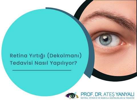 retina nedir,retina hastalıkları,retina tedavisi,istanbul retina tedavisi