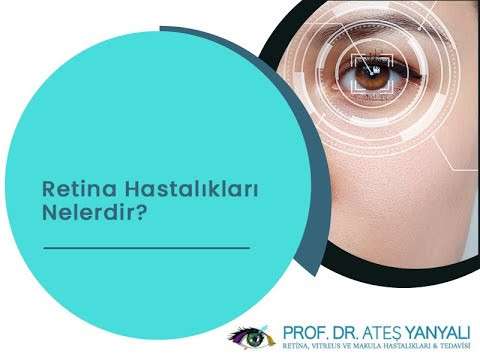 retina nedir,retina hastalıkları,retina hastalıkları nelerdir,ateş yanyalı,retina tedavisi,istanbul retina tedavisi