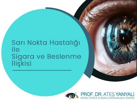 sarı nokta hastalığı,sarı nokta nedir,sarı nokta,dejenerasyon nedir,doç dr ateş yanyalı