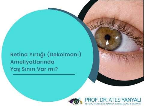 retina dekolmanı,retine yırtılması,retina ameliyatı,istanbul retina tedavisi,retina uzmanı,retina doktoru