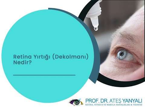 retina tedavisi,istanbul retina tedavisi,retina dekolmanı tedavisi,doç dr ateş yanyalı