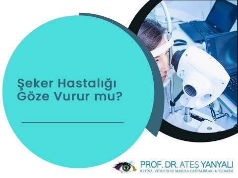 şeker hastalığı,şeker hastalığı ve göz,diyabet hastalığı,diyabet ve göz,ateş yanyalı