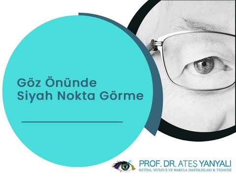 retina yırtılması,siyah noktalar,ateş yanyalı,doç dr ateş yanyalı,retina nasıl yırtılır,retina yırtılması nedir
