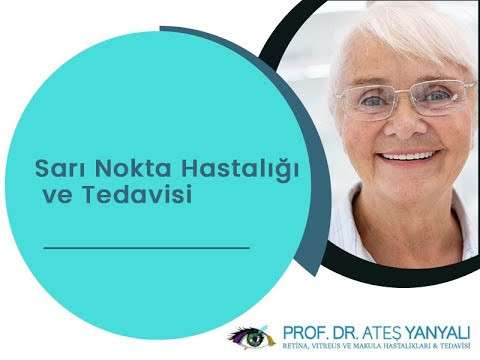 sarı nokta,sarı nokta hastalığı,sarı nokta nedir,istanbul sarı nokta tedavisi,sarı nokta tedavisi,ateş yanyalı,doç dr ateş yanyalı