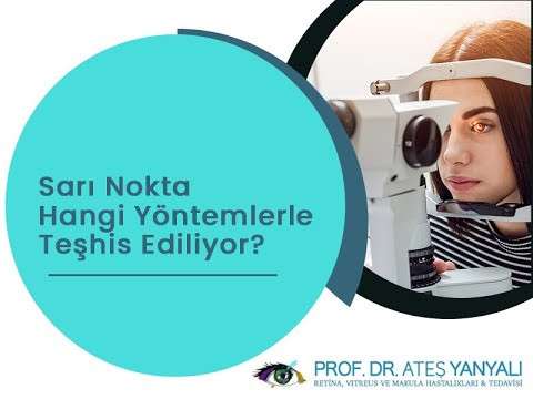 sarı nokta,sarı nokta nedir,sarı nokta hastalığı tedavisi,makula tanımı
