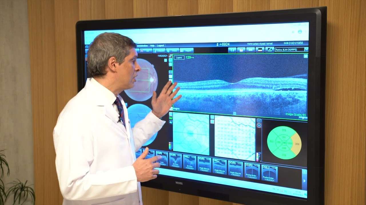 retina,retina hastalıkları,retina muayenesi,göz hastalıkları