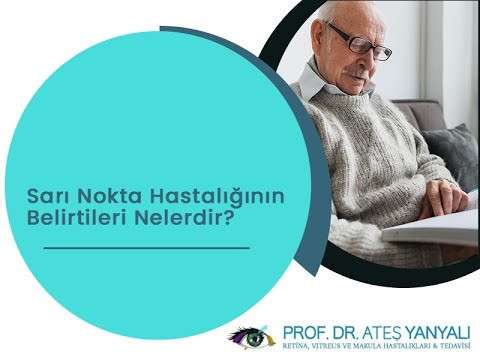 makula dejenerasyonu,sarı nokta hastalığı,sarı nokta tedavisi,sarı nokta hastalığı tedavisi,doç dr ateş yanyalı