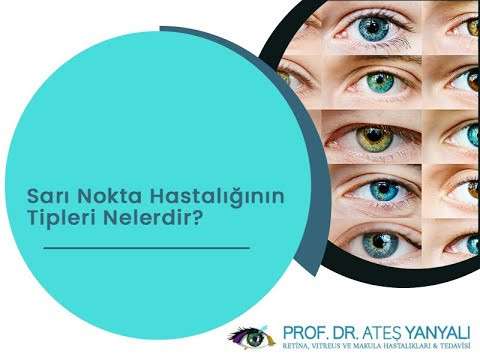 Sarı nokta hastalığı,Sarı nokta hastalığının tipleri,Sarı nokta hastalığının tipleri nelerdir