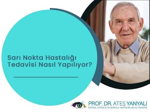 sarı nokta hastalığı,sarı nokta hastalığı tedavisi,sarı nokta hastalığı nasıldır,sarı nokta hastalığı çözümü,makula nedir,makula dejenerasyonu,makula dejenerasyonu nedir,doç dr ateş yanyalı
