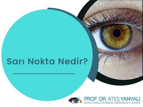 sarı nokta,sarı nokta nedir,sarı nokta hastalığı,sarı nokta tedavisi,doç dr ateş yanyalı