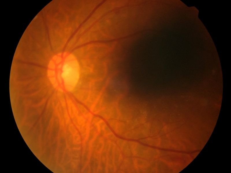 fotobiyomodulasyon-nedir