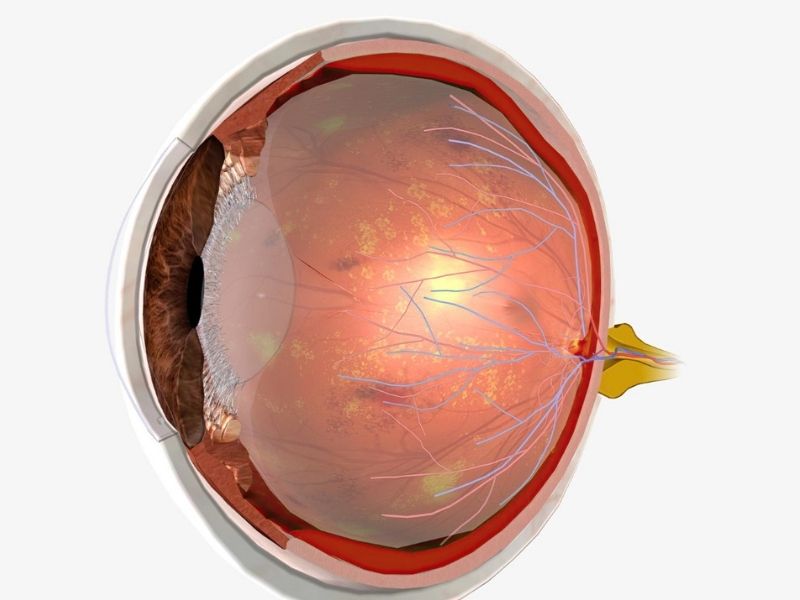 retina-dekolkamani
