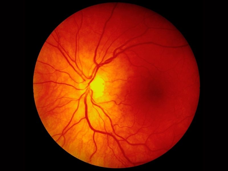 retina
