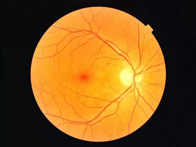 Retina-damar-tıkanıklığı