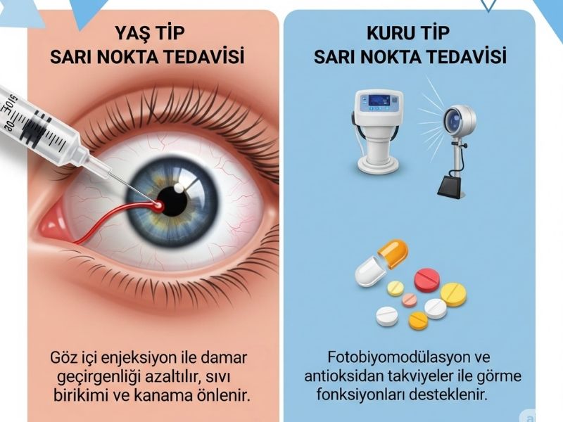 kuru-tip-sari-nokta-tedavisi