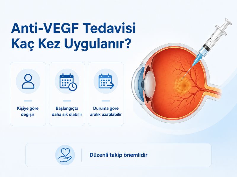 anti-vegf-tedavisi-kac-kez-uygulanir