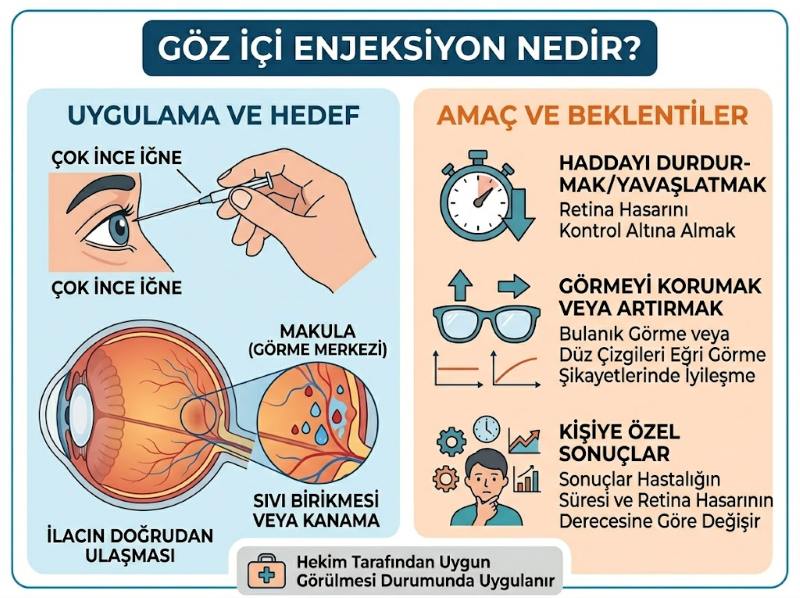 goz-ici-enjeksiyon-nedir