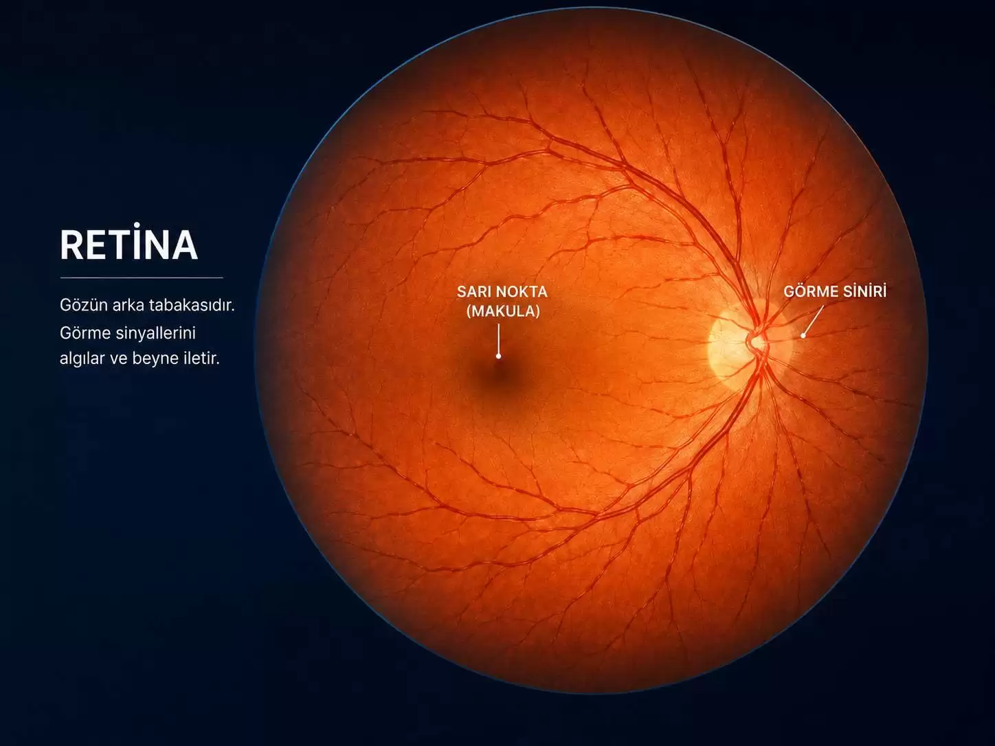 Retina ve sarı nokta bölgesinin görünümü.